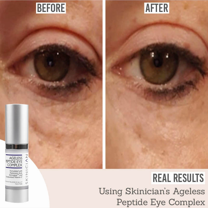 Ageless Peptide Eye Complex