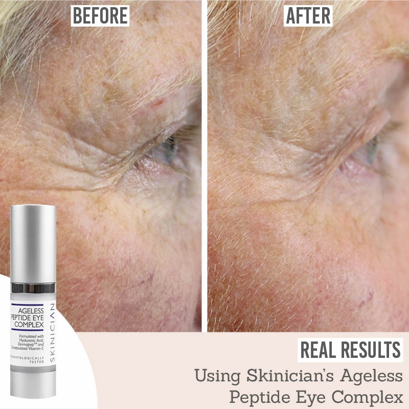 Ageless Peptide Eye Complex