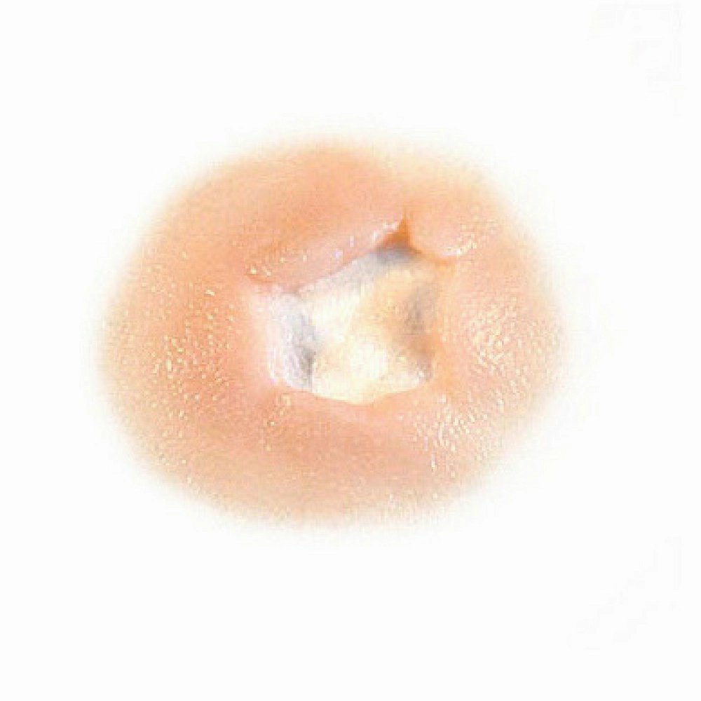 Out of Kit Exit Wound (Small)