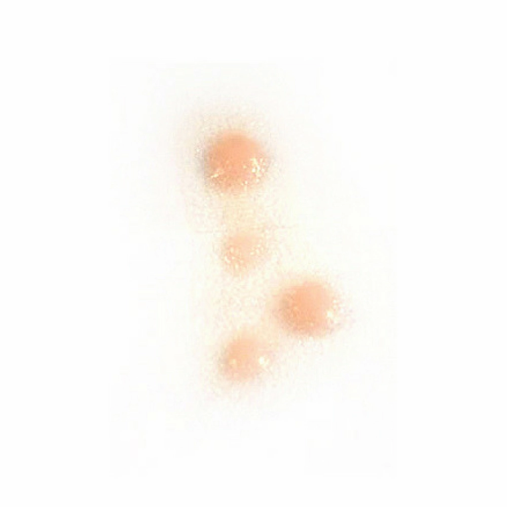 Out of Kit Spot Cluster
