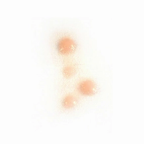 Out of Kit Spot Cluster