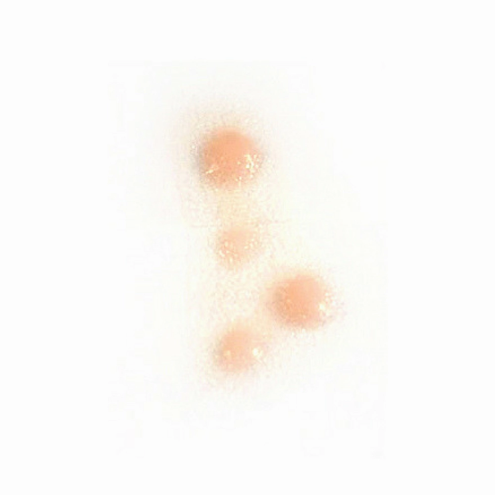 Out of Kit Spot Cluster